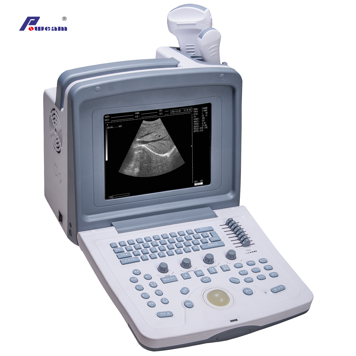 Escáner de ultrasonido digital portátil aprobado por CE (WHYC30P)