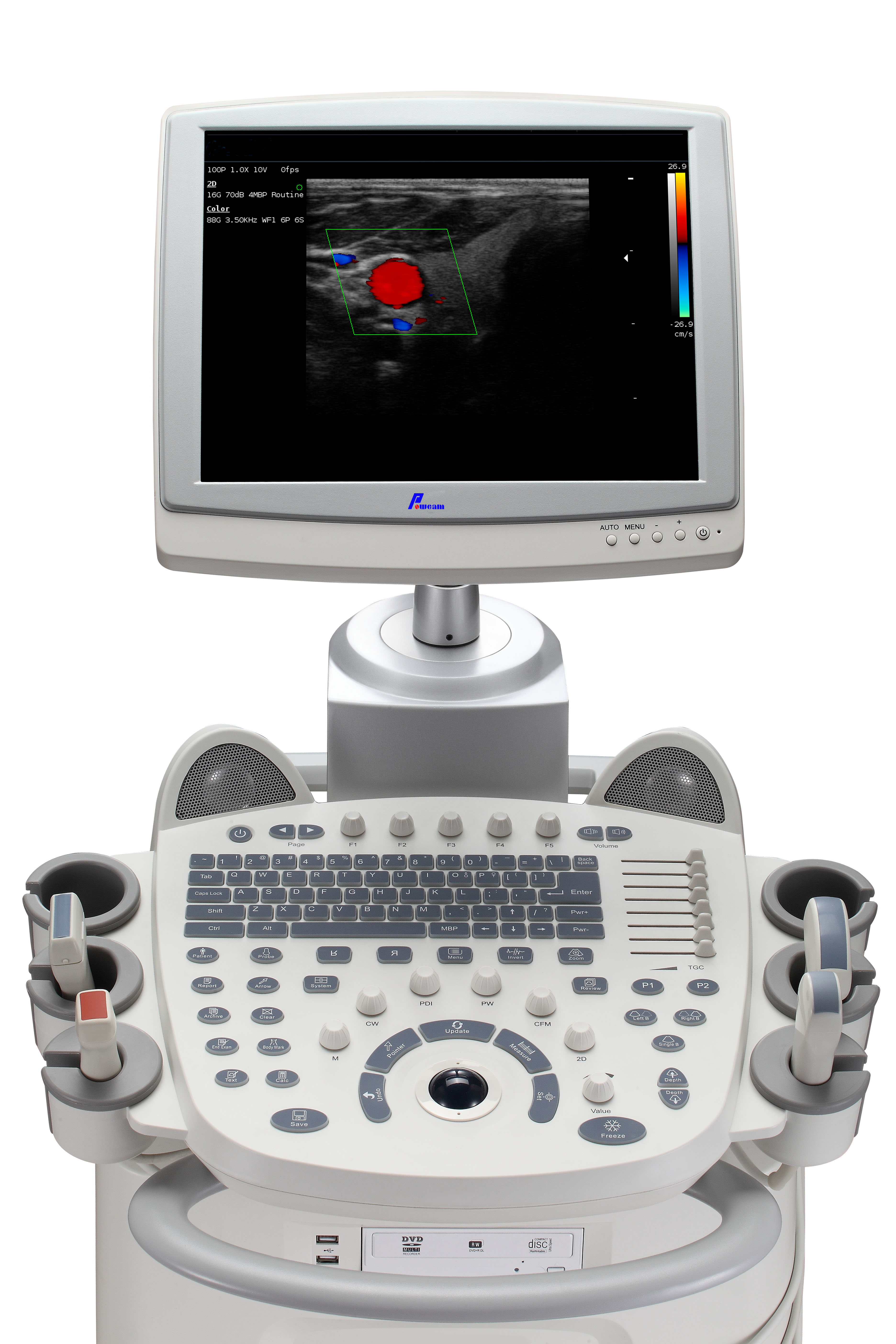 Hospital médico portátil y móvil Sonoscape 4D Color Doppler