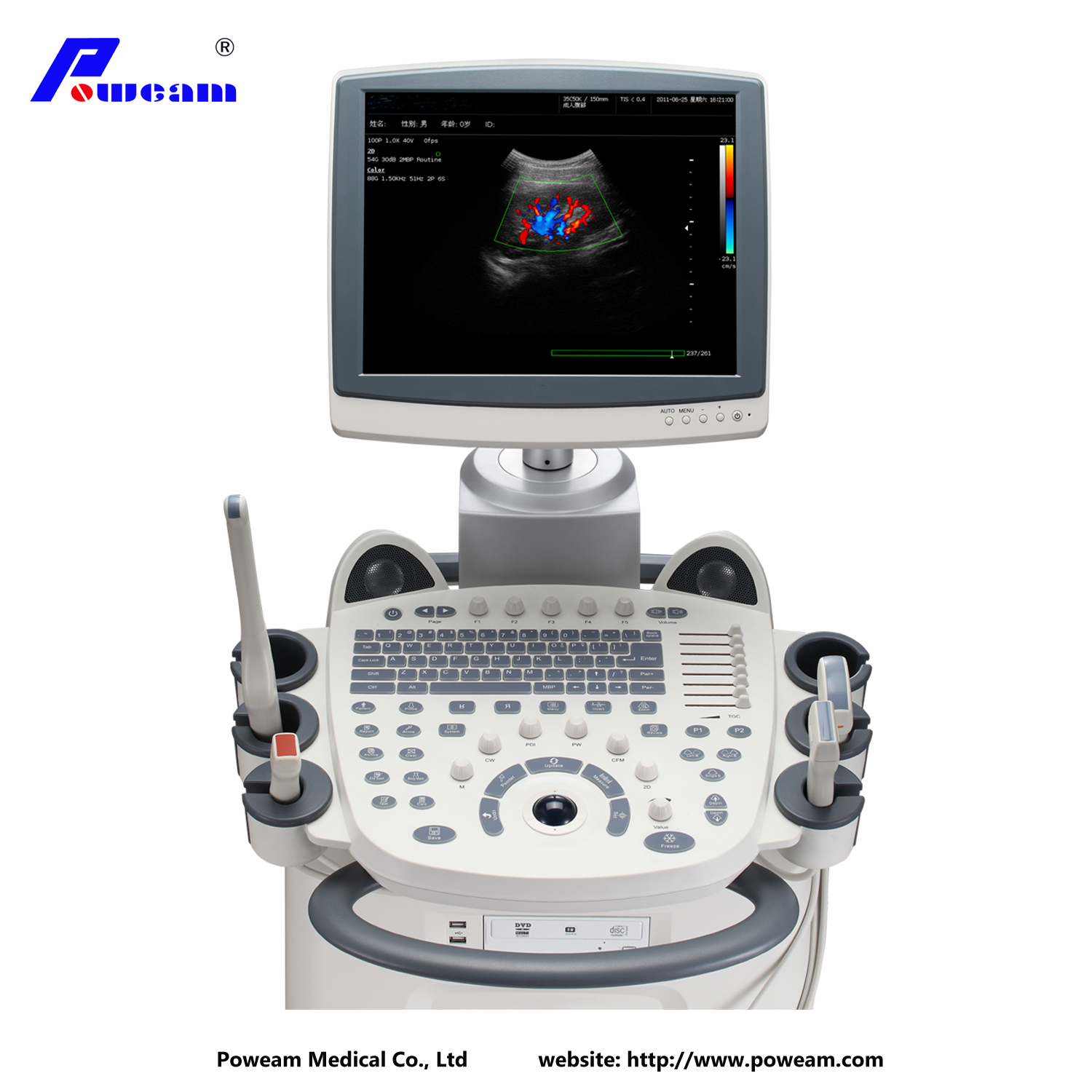 Escáner de ultrasonido Doppler de la máquina de ultrasonido 3D 4D (D70)